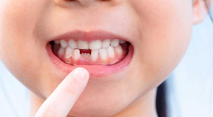 رویش دندان شیری و دائمی