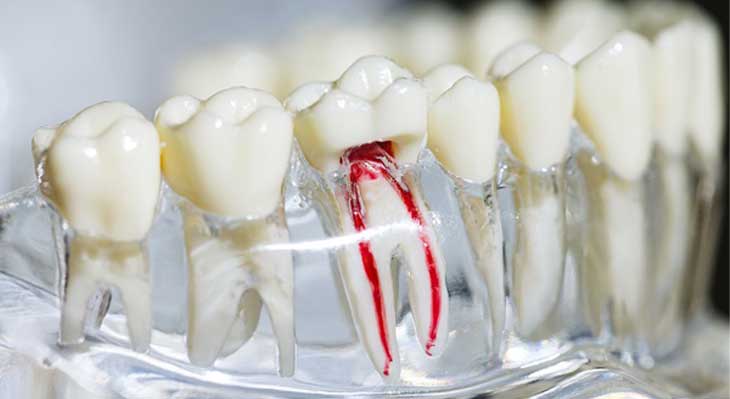 آیا دندان شیری ریشه دارد؟