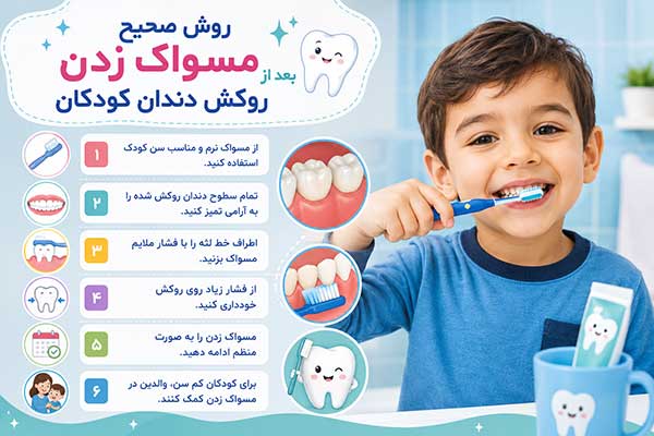 مراقبت های بعد از روکش دندان کودکان