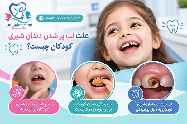 لب پر شدن دندان شیری کودکان