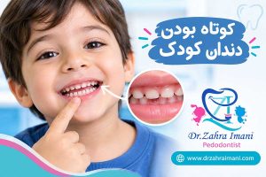 کوتاه بودن دندان کودک