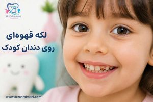 لکه قهوه ای روی دندان کودک