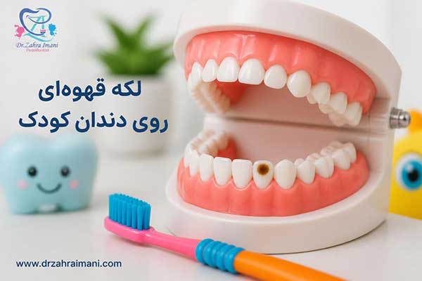 لکه قهوه‌ ای روی دندان کودک